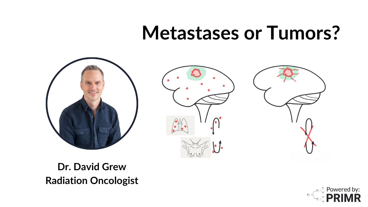 Brain Metastasis or Brain Tumor?