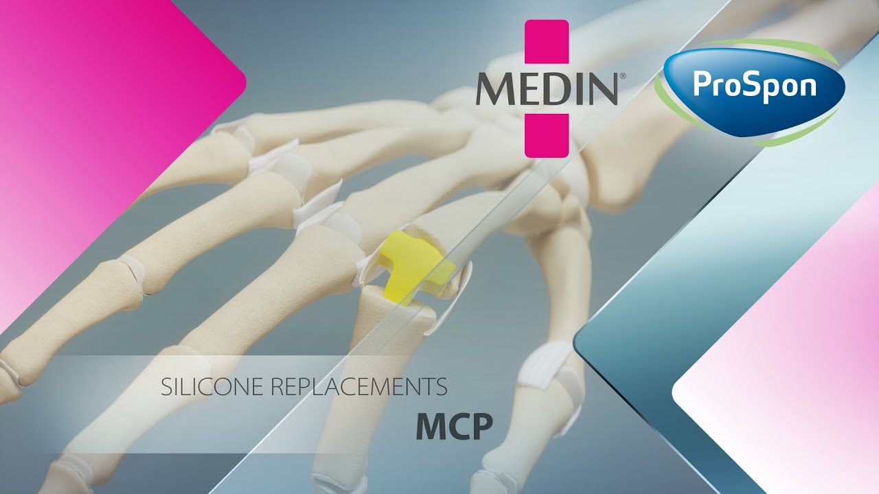 MCP joint replacement