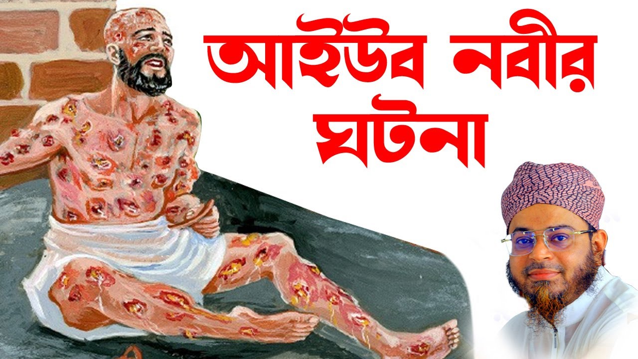 Mufti nasir uddin ansari | নাসির উদ্দিন আনসারী। আইউব নবীর ঘটনা   | Ansari Waz | bd tv