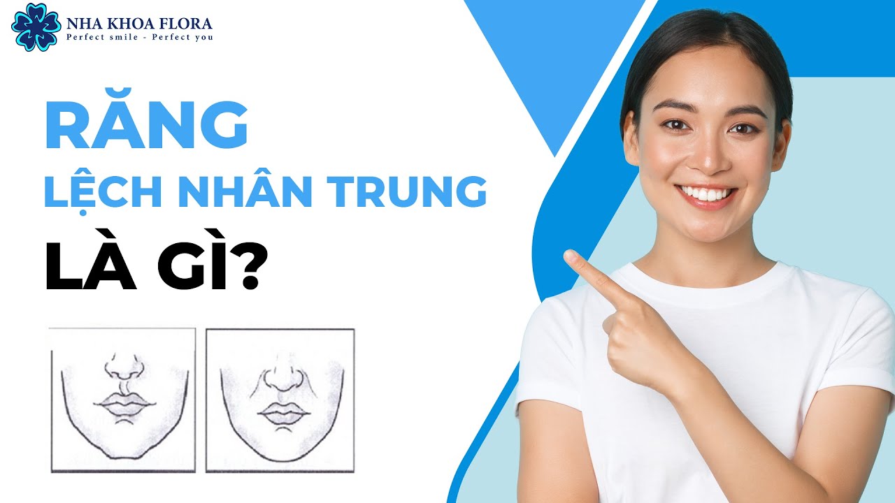 NHA KHOA FLORA | RĂNG LỆCH NHÂN TRUNG LÀ GÌ?