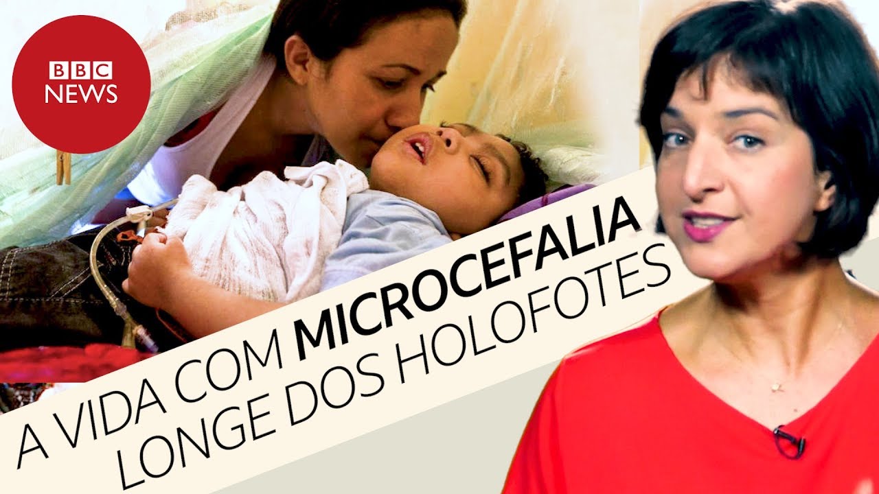 Como vive a 1ª geração de bebês com microcefalia por zika