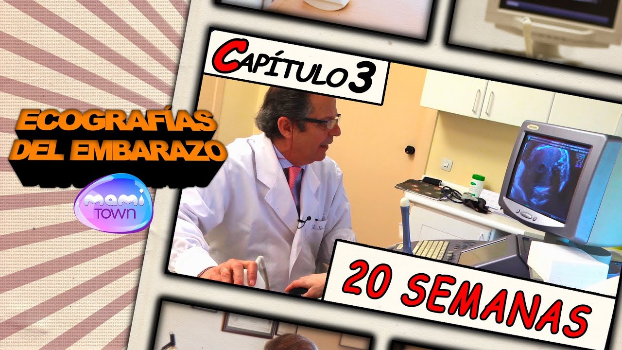 Ecografía Semana 20