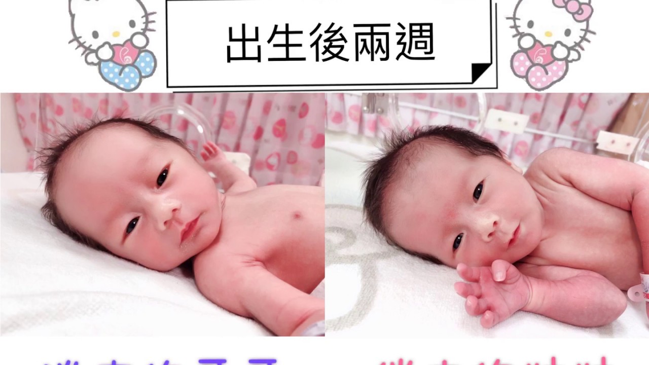 ‼️打破迷思 雙胞胎剖腹生產‼️
