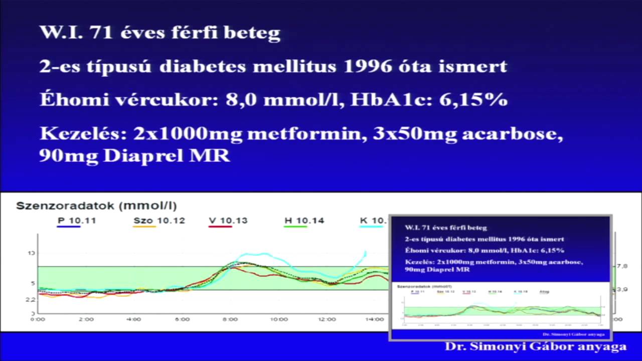 Dr. Kempler Péter - a 2-es típusú diabetes kezelése - Szemléletváltás - Új ajánlások