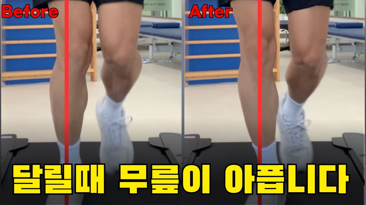 러닝 무릎통증 