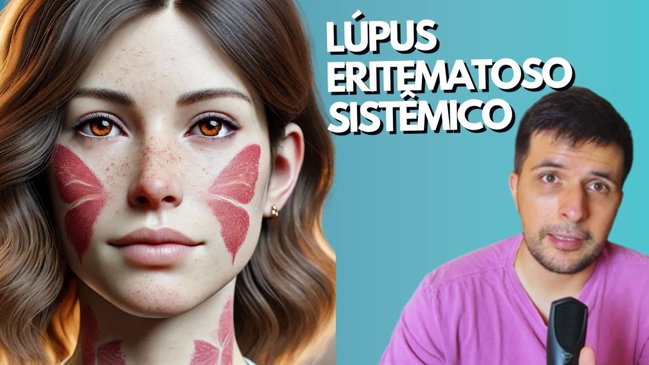 Junta (episódio 05) - Lúpus Eritematoso Sistêmico (LES)