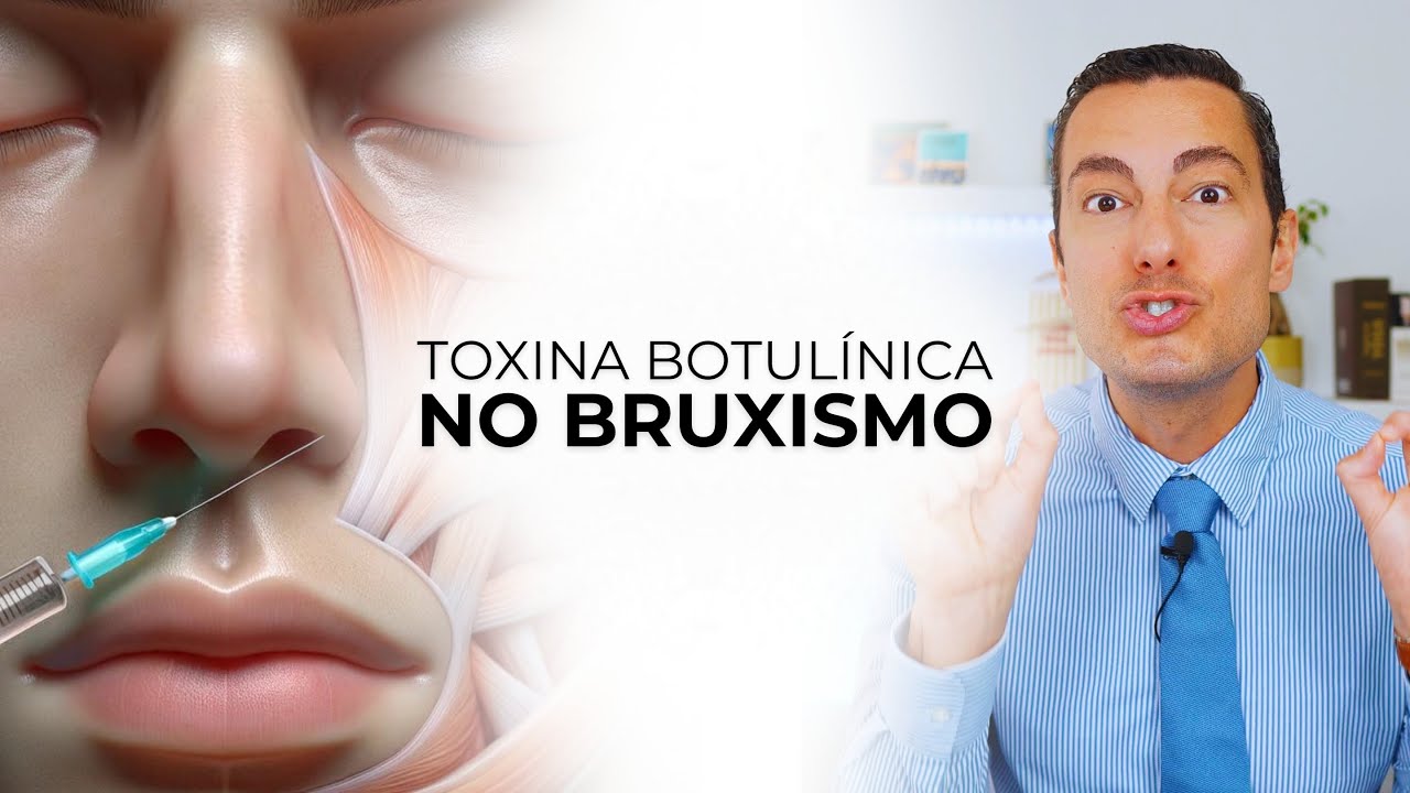 Botox no Bruxismo? DENTISTA EXPLICA Bruxismo, DTM e Dor