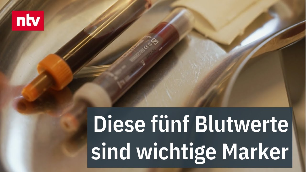 Diese f&uuml;nf Blutwerte sind wichtige Marker: Regelm&auml;&szlig;iger Gesundheits-Check