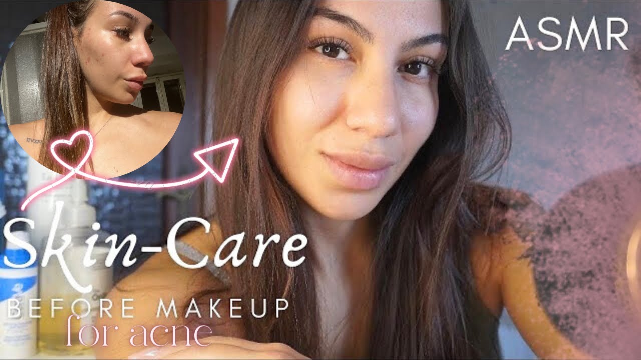 ♥ SKIN CARE ROUTINE  ♥ Acne & Macchie Post Acne| ASMR