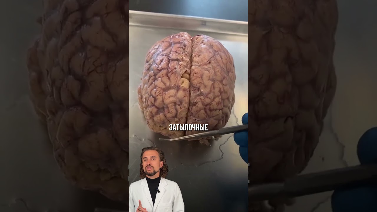 Продольная щель — граница между двумя половинами мозга.