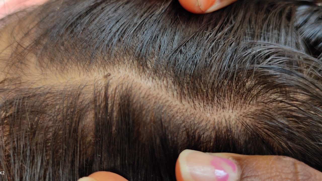 heavy nitpicking by long hair//in Telugu mamatha vlogs