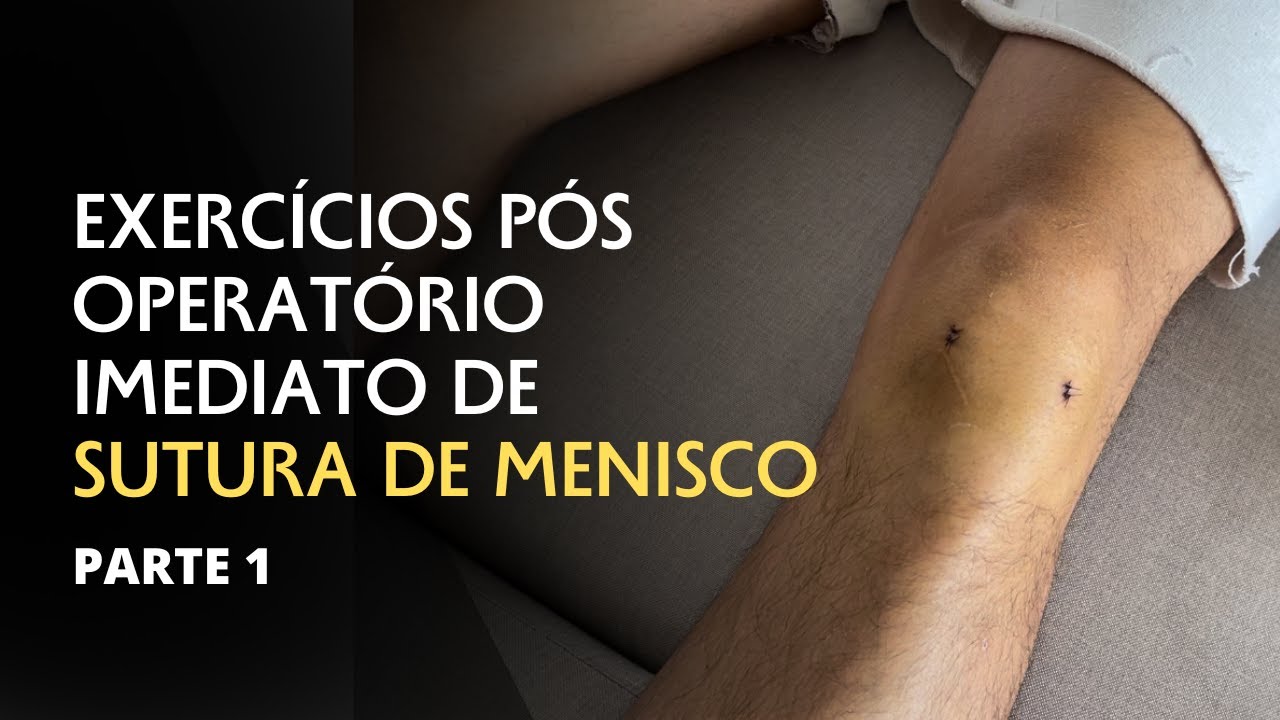 FISIOTERAPIA PARA CIRURGIA DE MENISCO - EXERCÍCIOS DE PÓS OPERATÓRIO IMEDIATO [parte 1]