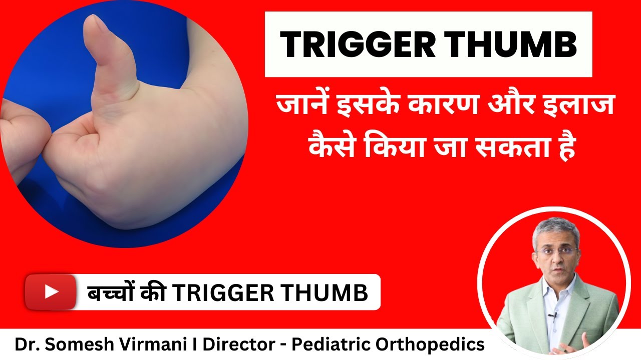 👍🏻 बच्चों में Trigger Thumb का इलाज| 👍🏻 𝗧𝗿𝗶𝗴𝗴𝗲𝗿 T𝗵𝘂𝗺𝗯 𝘁𝗿𝗲𝗮𝘁𝗺𝗲𝗻𝘁 𝗶𝗻 Hindi | 𝗣𝗲𝗱𝗶𝗮𝘁𝗿𝗶𝗰 𝗧𝗿𝗶𝗴𝗴𝗲𝗿 𝗧𝗵𝘂𝗺𝗯