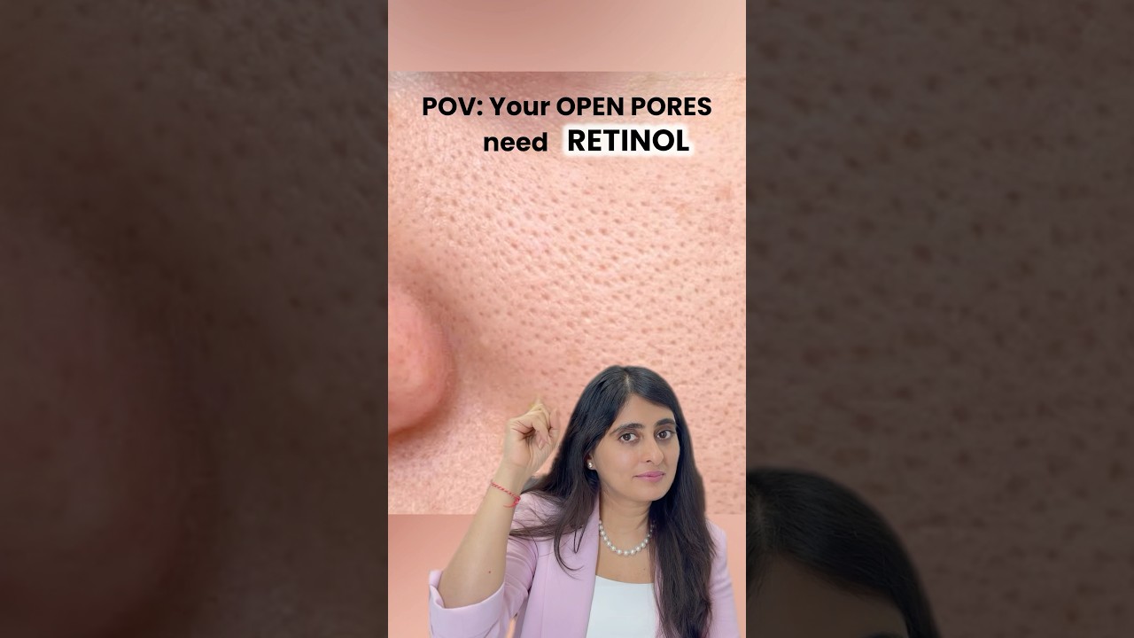 Open Pores | Open pores serum | Cream for open pores | Retinol for open pores