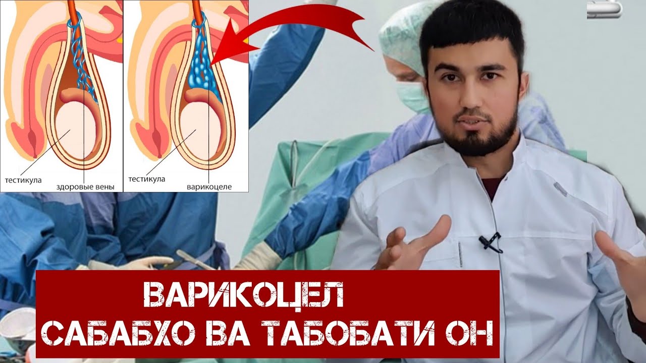 Варикоцел-сабабхо ва табобати он