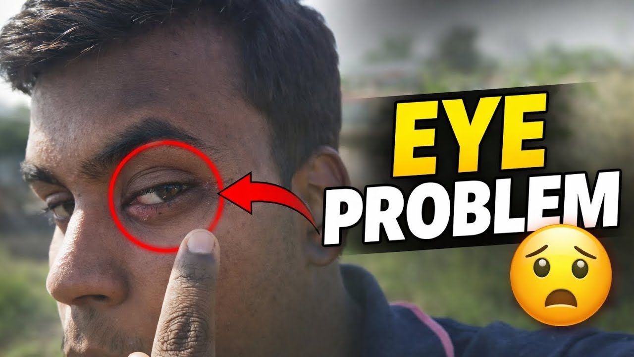 Eye problem vlog 👁️👁️