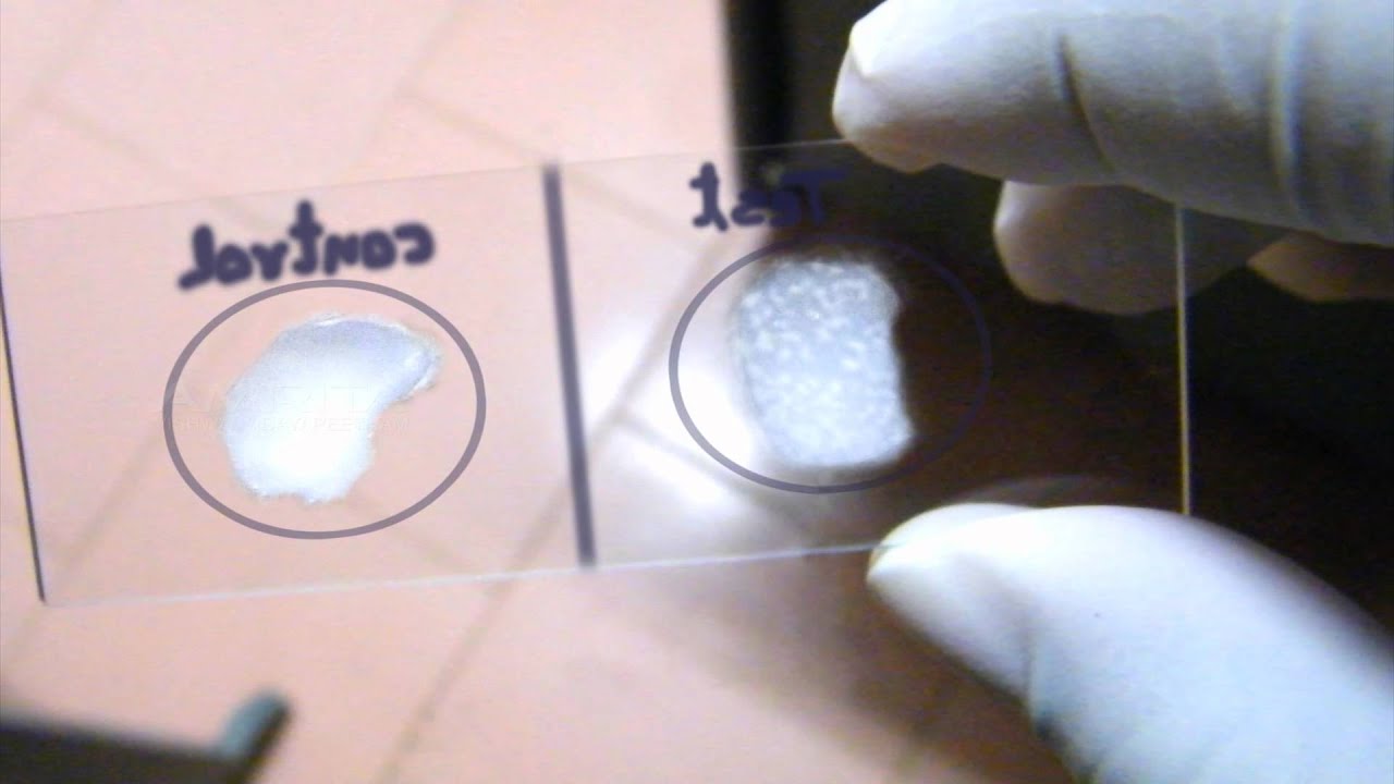 Coagulase Test - Amrita University