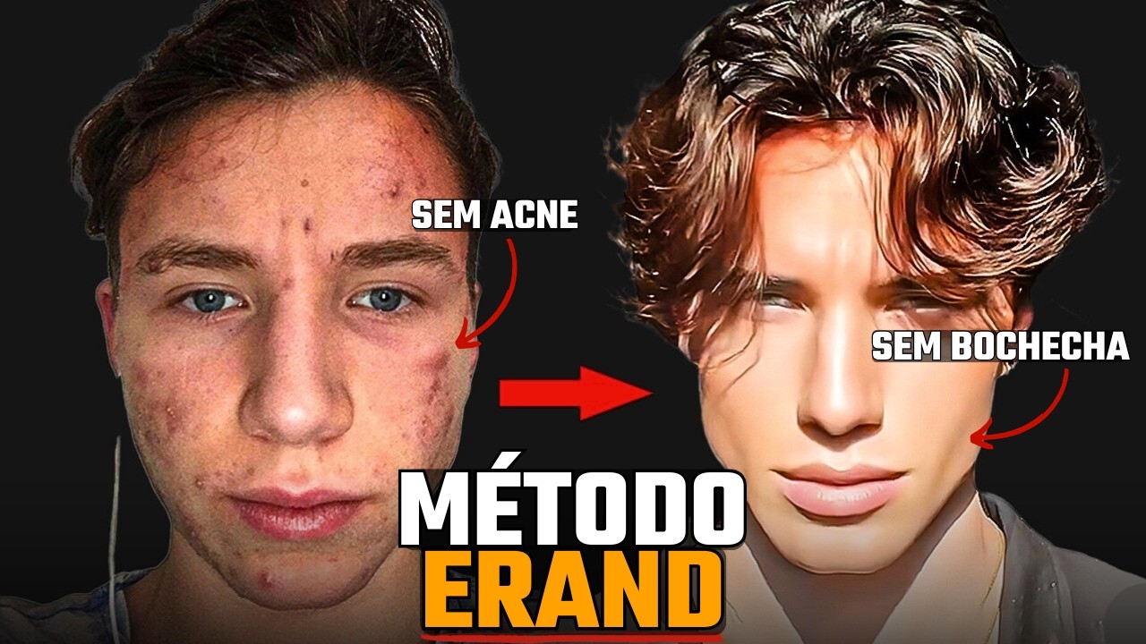 Homem FEIO teve GLOW UP e virou MODELO da CALVIN KLEIN (Método Completo Explicado)