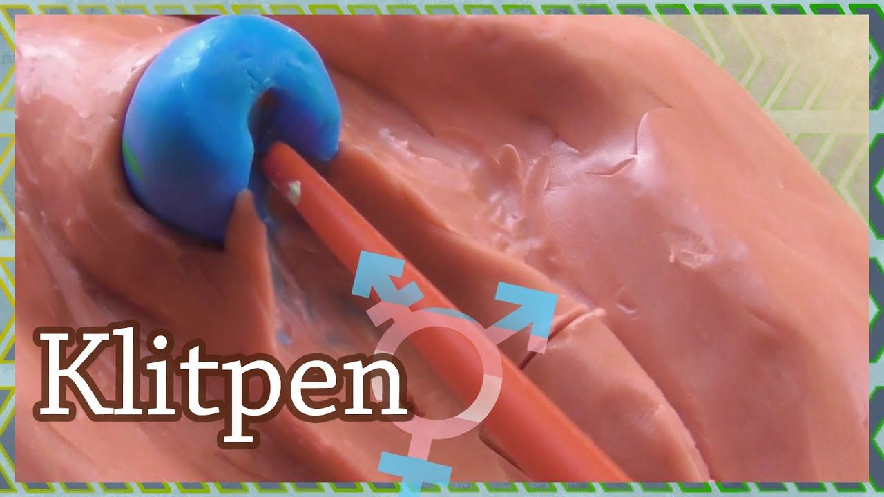 ²⁷·¹⁰·²⁰¹⁹ Wie funktioniert die Klitpen-OP?