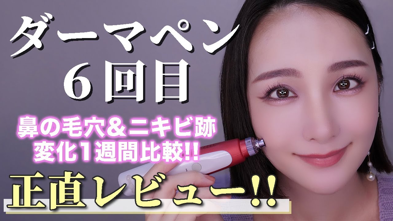 【セルフダーマペン】6回目‼️毛穴＆ニキビ跡の変化約1週間高画質で比較💪✨【正直レビュー】
