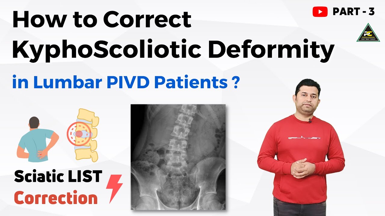 PHYSIOTHERAPY TREATMENT FOR SCIATIC LIST / SCOLIOSIS IN DISC PROLAPSE PATIENTS.