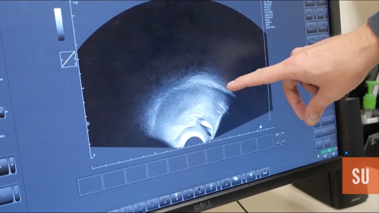 Jonathan Preston - Ultrasound use in Speech-Language Pathology
