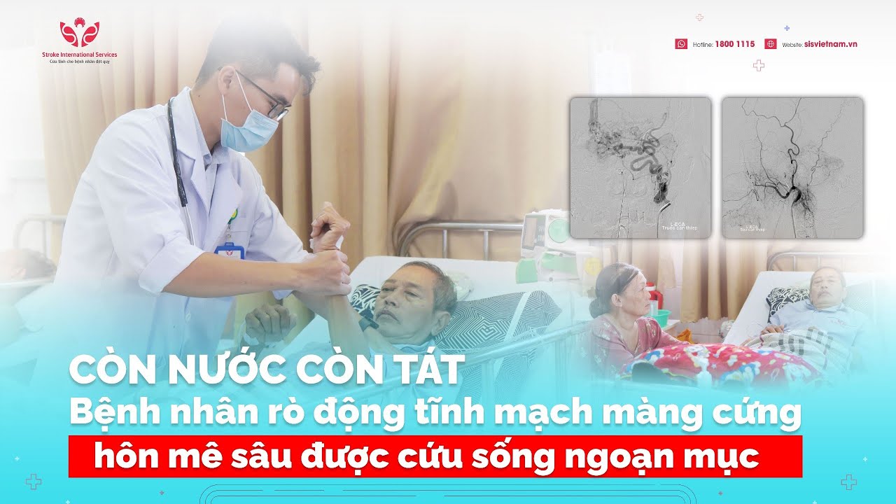Cụ ông nguy cơ tử vong do rò động tĩnh mạch màng cứng gây hôn mê sâu