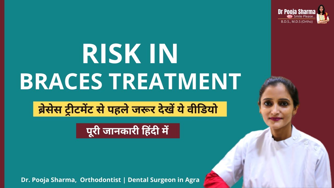 Braces Treatment Risk | Orthodontic Treatment in Agra, Uttar Pradesh - Dr. Pooja Sharma