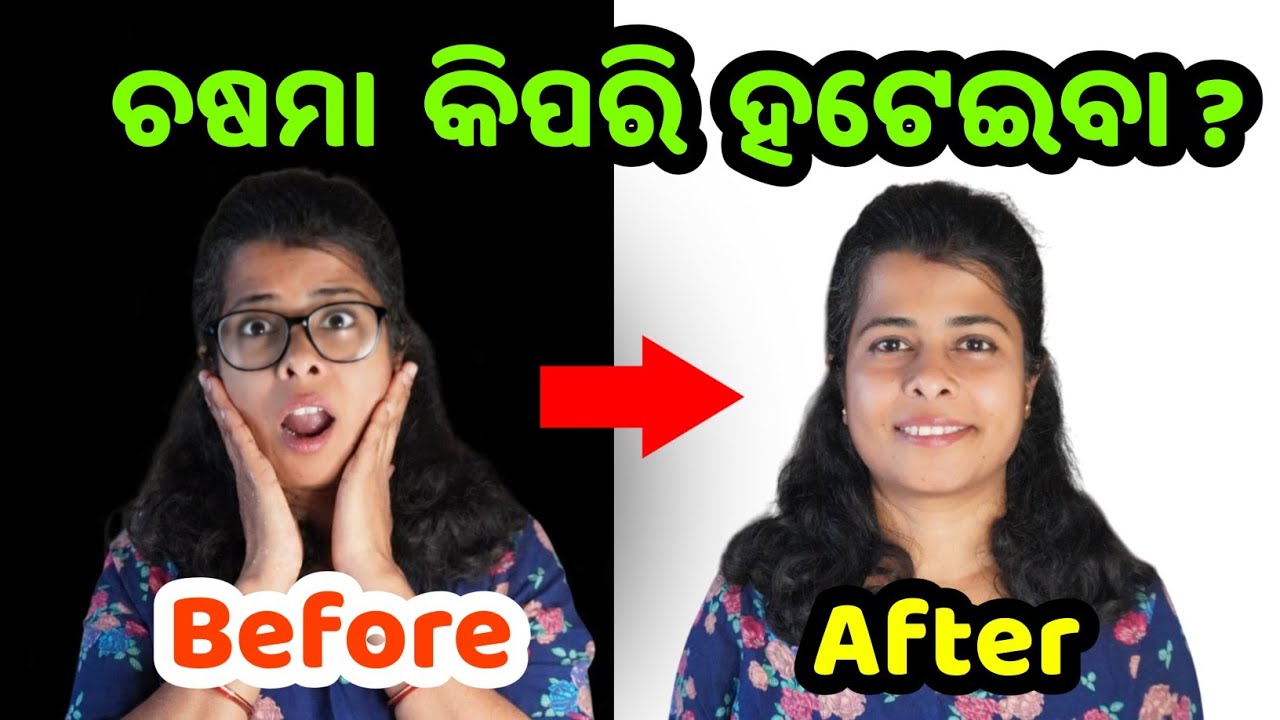 How to Save Your EYES from Spectacle Naturally /Odia Health Tips 