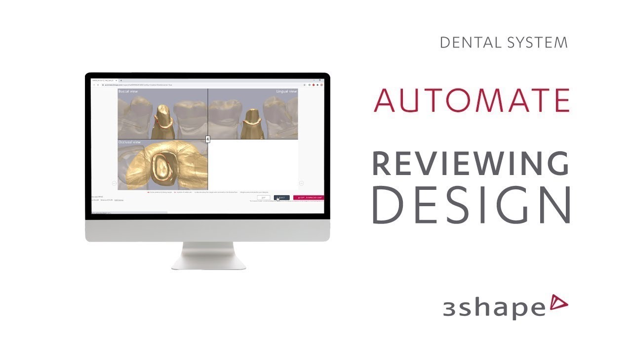 3Shape Automate – Reviewing the design