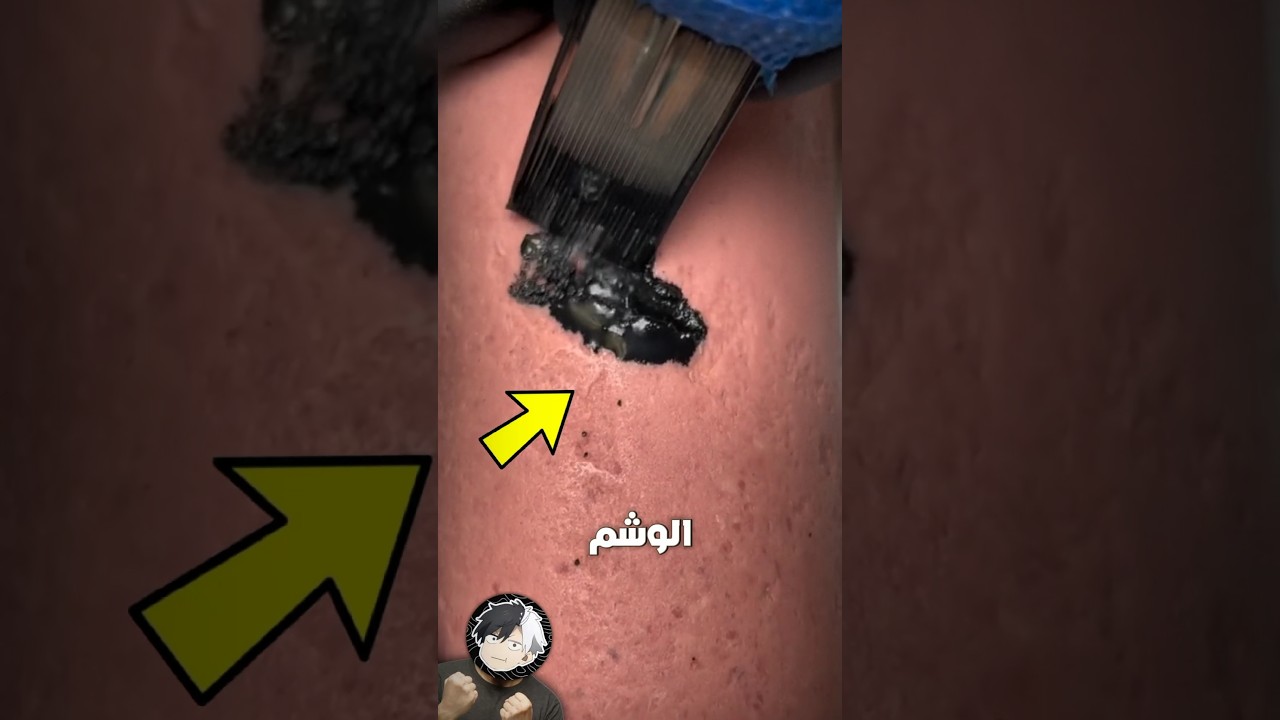 كيف يوضع الوشم😳💔!!؟