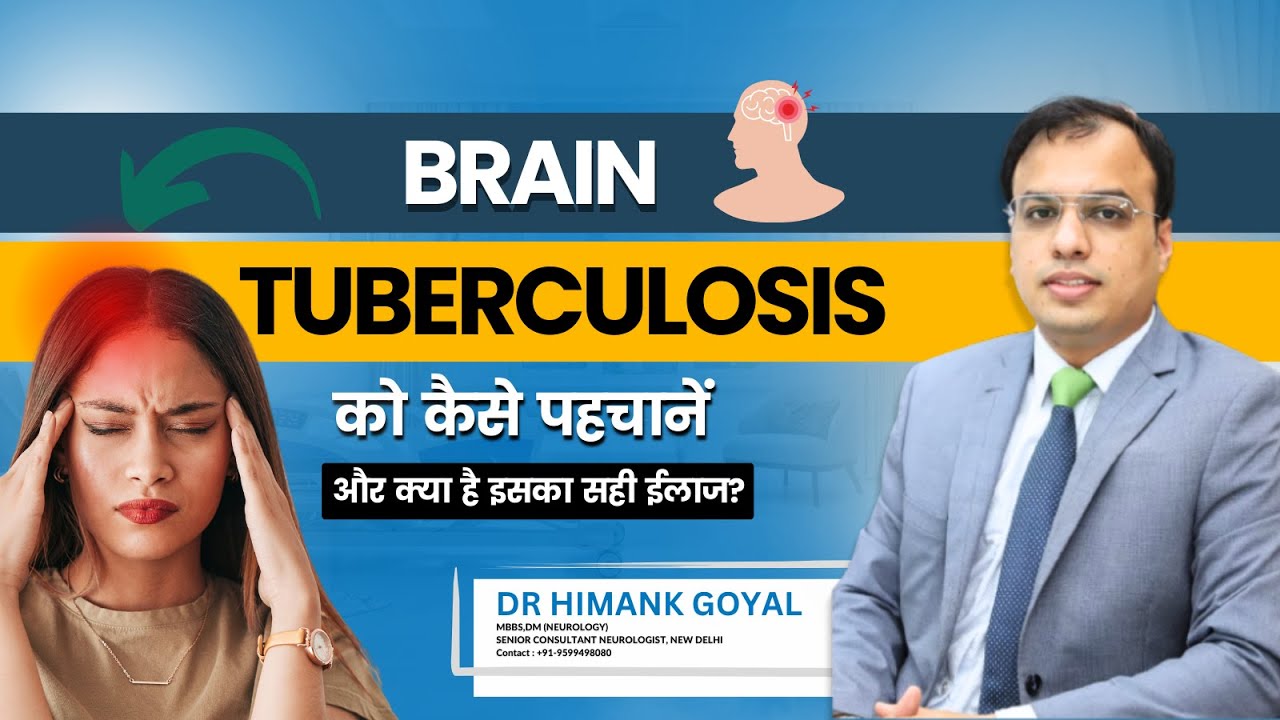 Brain Tuberculosis को कैसे पहचानें और क्या है इसका सही ईलाज? | Brain TB in Hindi | Dr. Himank Goyal