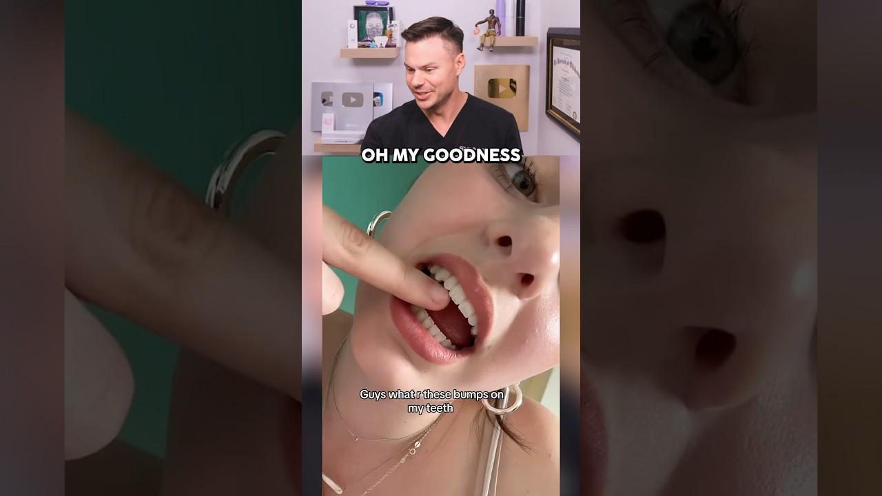 The Real Reason Why Your Teeth May Have BUMPS! 😮🦷