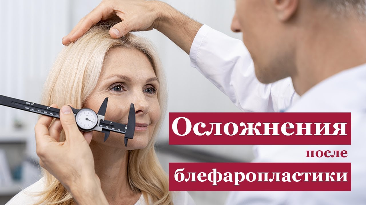 Осложнения после блефаропластики. Слепота и 