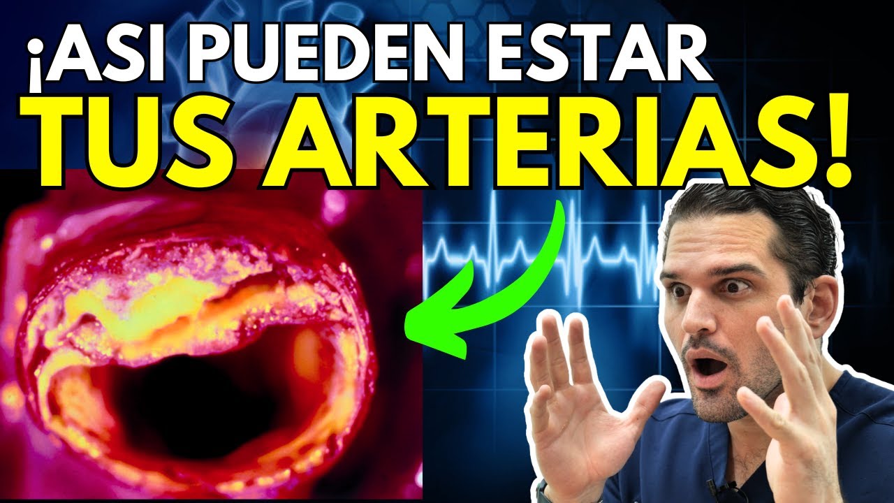 ¡Descubre tu PUNTAJE de Calcio y Protege tu Corazón!  😲