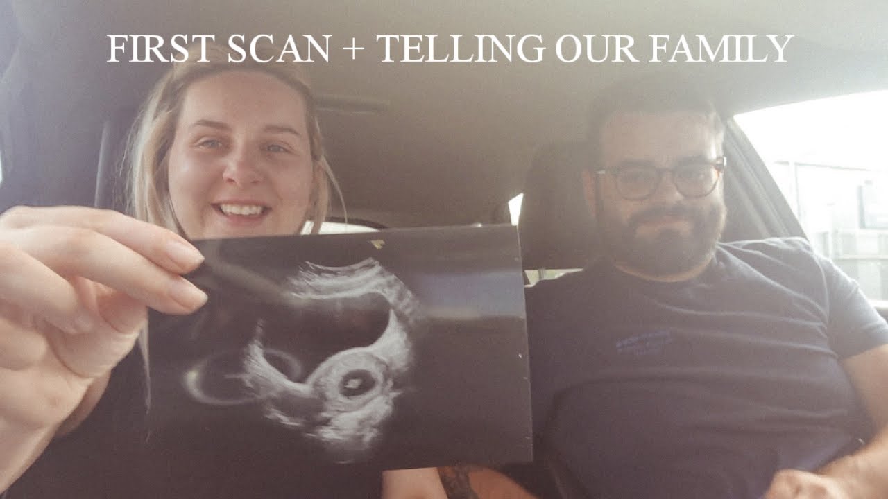 FIRST SCAN | Telling our friends and family, baby announcement 👶🏼🤍