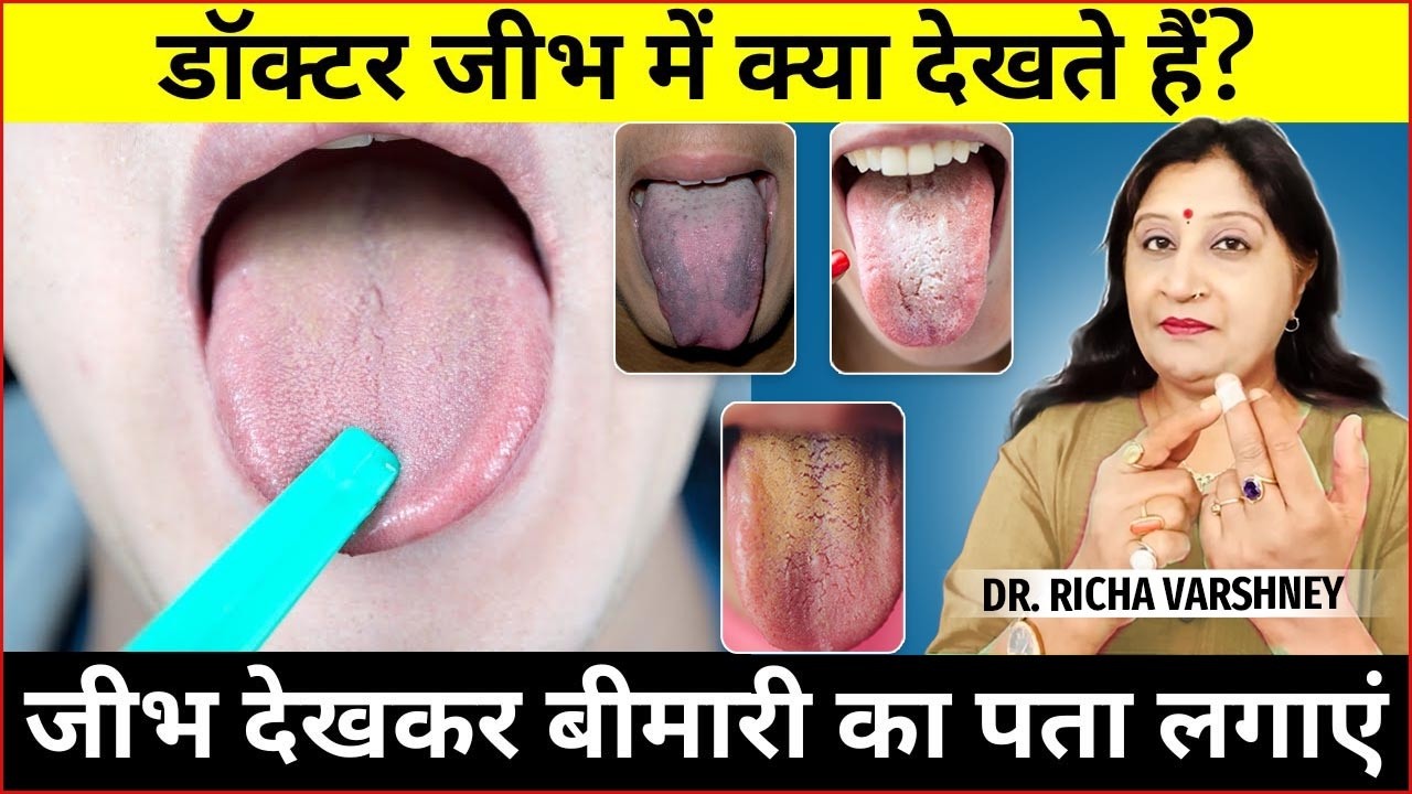 जीभ से जानिए शरीर की बीमारी | Tongue Diagnosis for Kidney, Liver & Heart | Acupressure Treatment