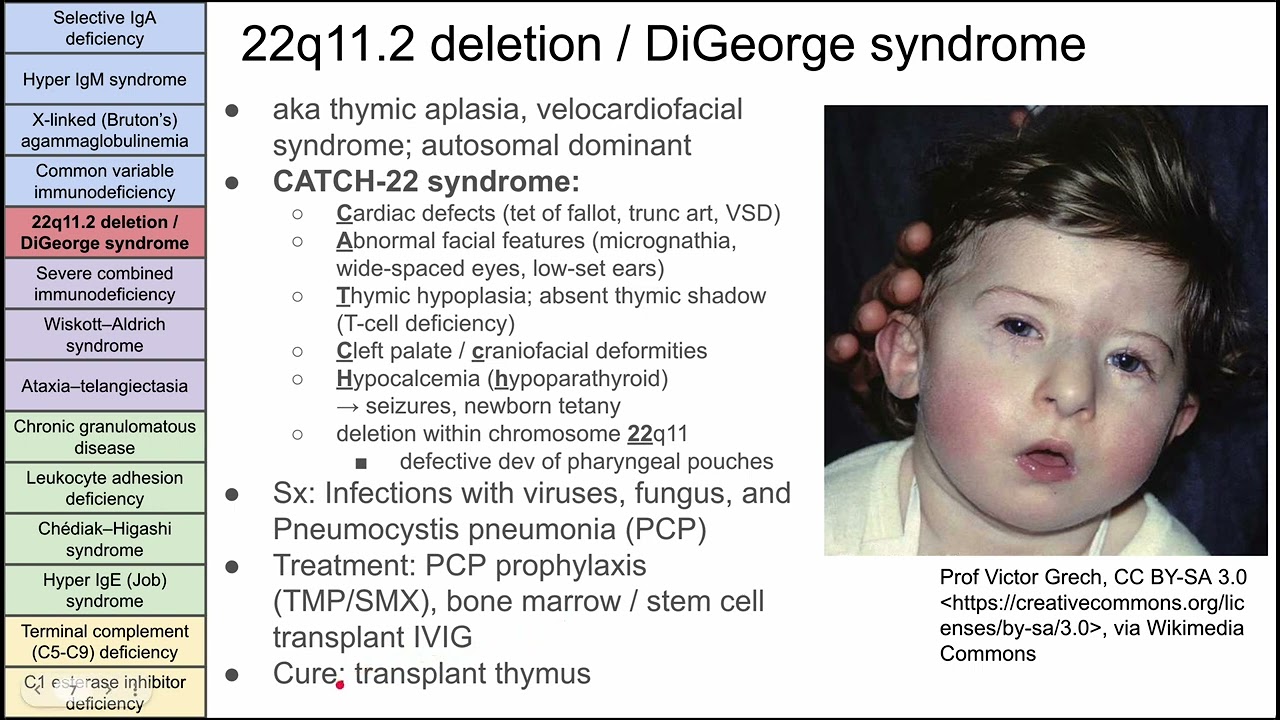 Primary immunodeficiency disorders