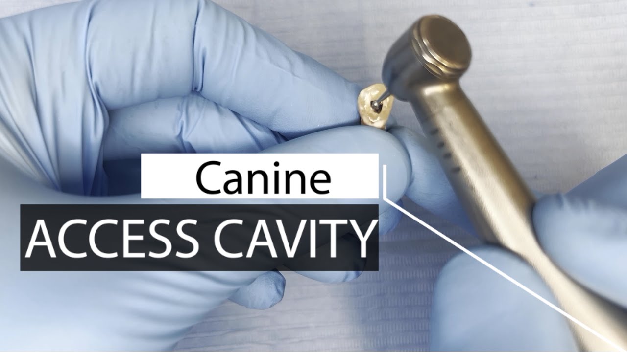 🔵Maxillary and Mandibular Canine - Endodontic Access Cavity Preparation-Episode 1