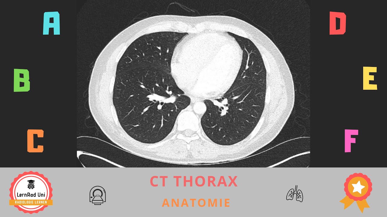 Anatomie im CT Thorax – Grundlagen für Studium & Weiterbildung