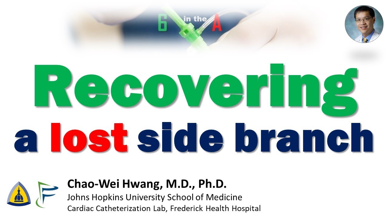 Recovering a Lost Side Branch