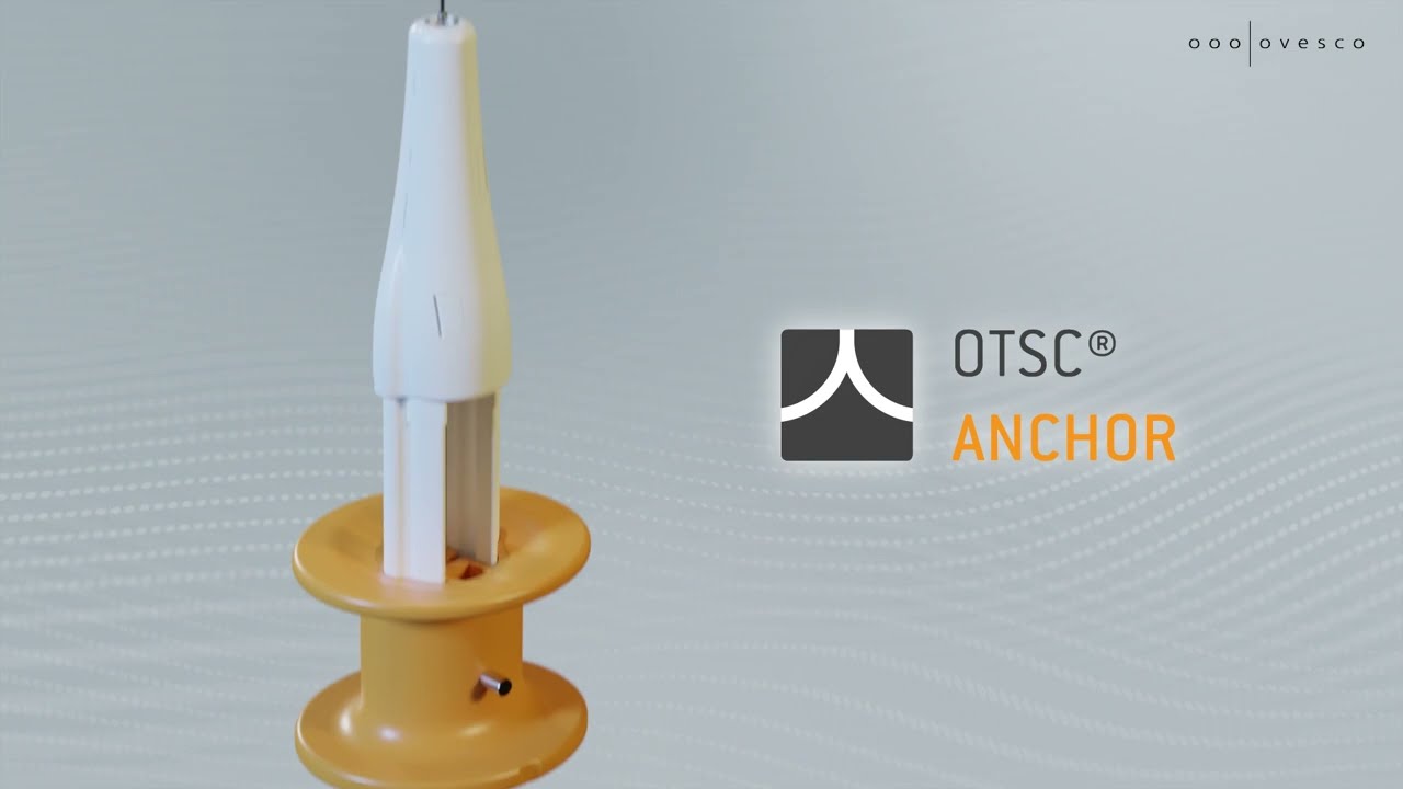 How to | OTSC&reg; Anchor f&uuml;r die H&auml;mostase