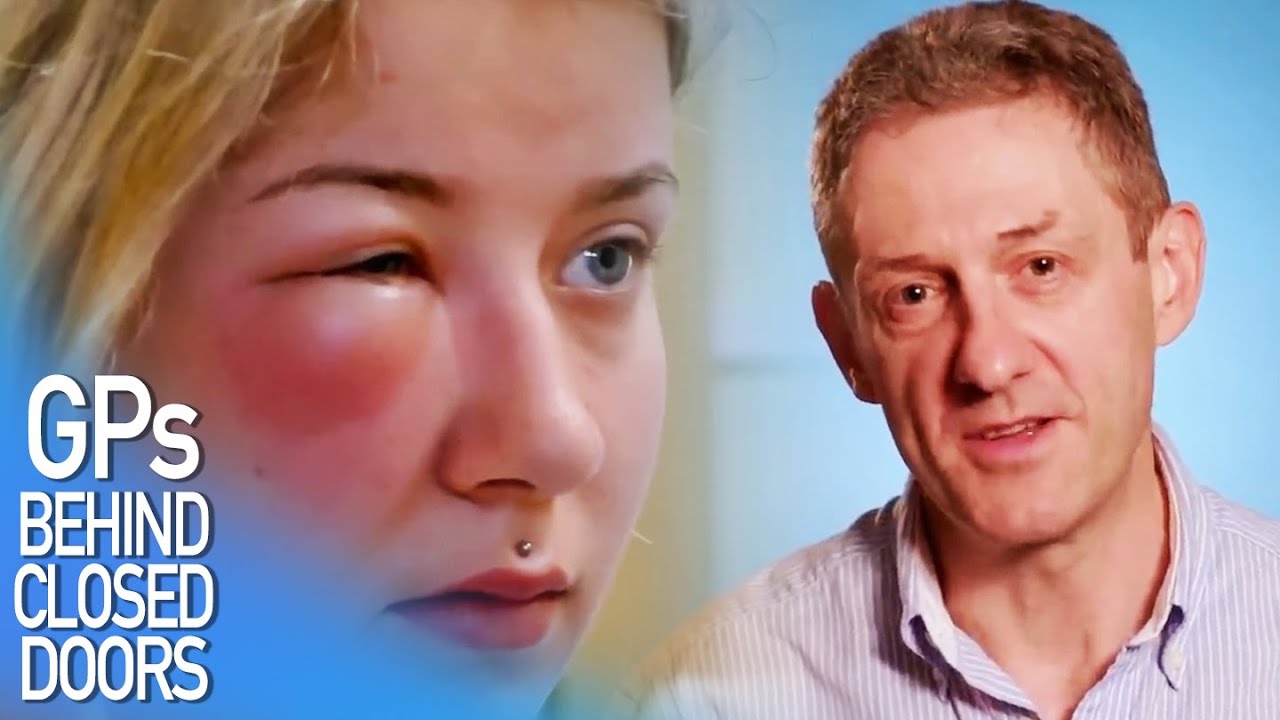 Wasp Sting & Blood Pressure Review | GPs: Behind Closed Doors