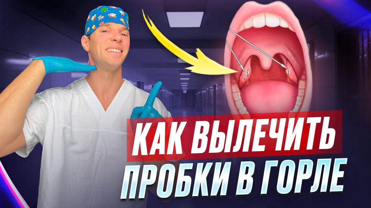 Белые пробки в гландах. Хронический тонзиллит. Миндалины. Как их лечить.
