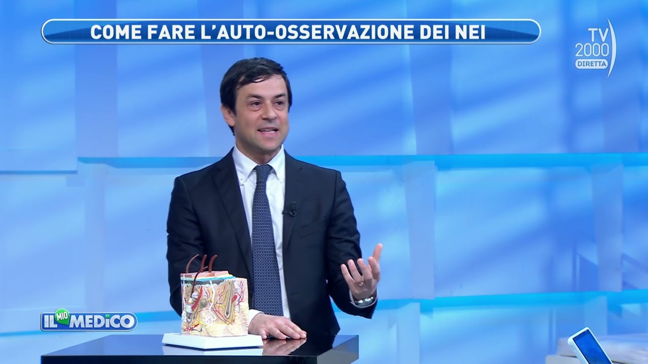 Il Mio medico (TV2000) - Nei, dalla diagnosi alla rimozione