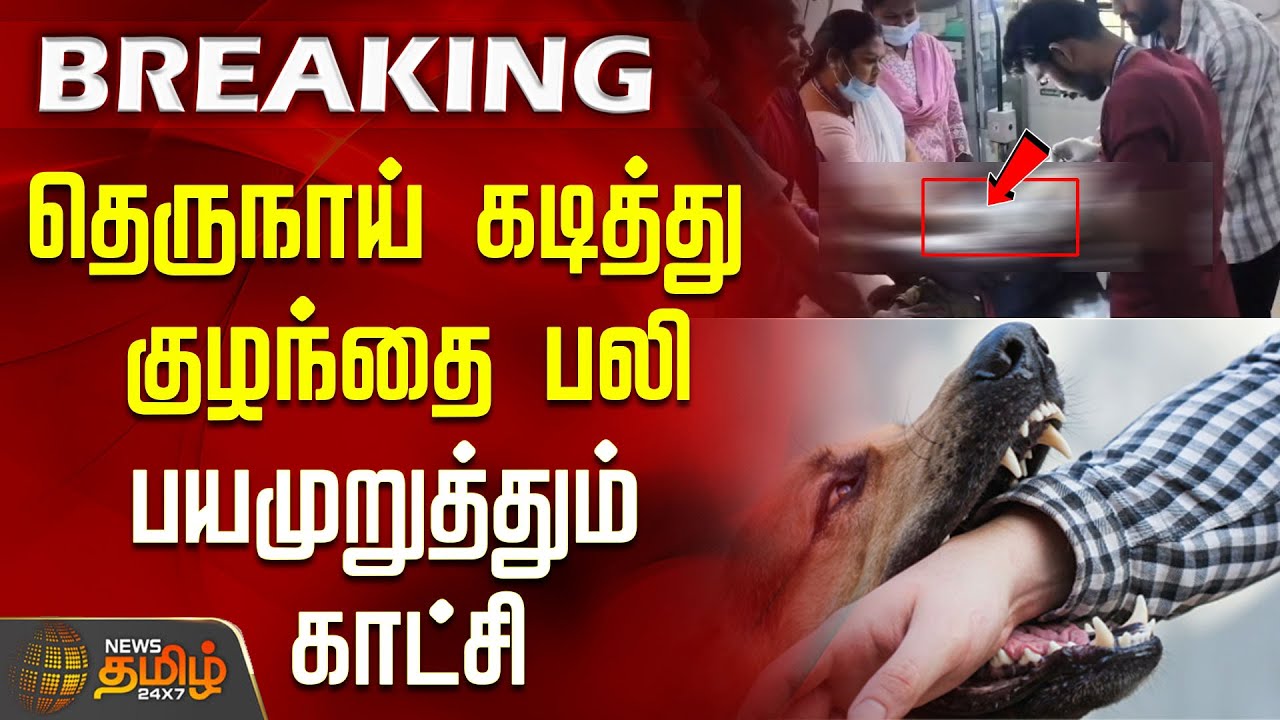 தெருநாய் கடித்து குழந்தை பலி - பயமுறுத்தும் காட்சி | Hosur Street dog bites child | Tamil Breaking
