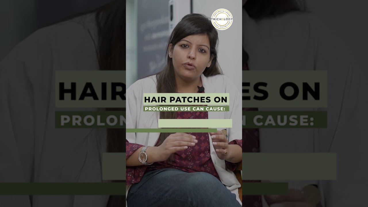 How does hair patch damages your skin? Know the truth | DMC Trichology