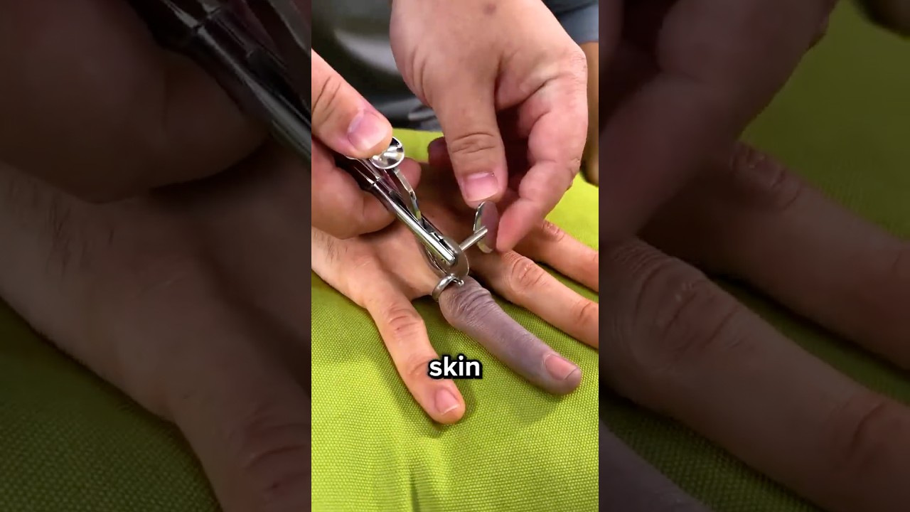 How To Actually Remove A Stuck Ring