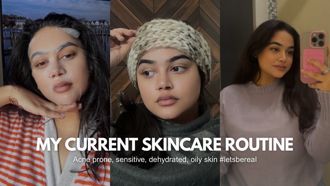 My Current Skincare Routine (With Active Acne) | Real Skin Creator