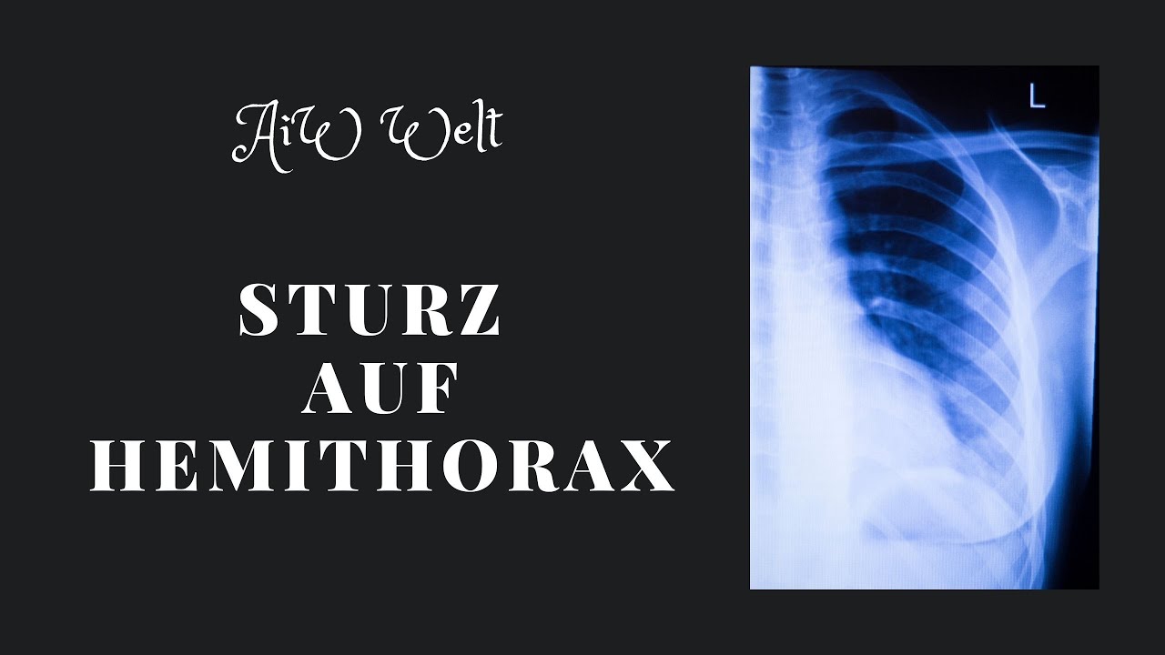 Sturz auf den Hemithorax, was zu tun ?